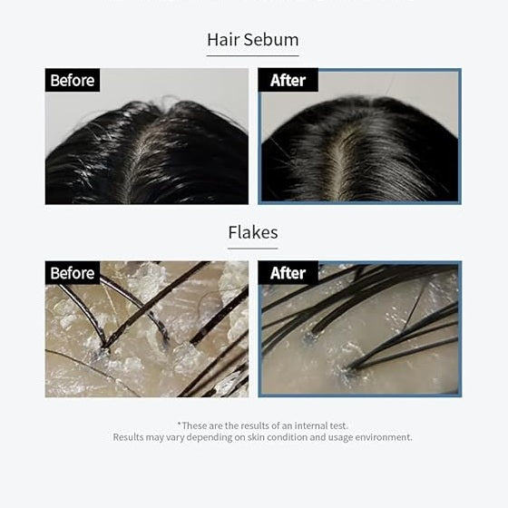 GROWUS Sea Salt Therapy Scalp Scaler 250g