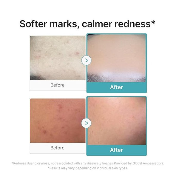 MEDICUBE Azelaic Acid 16 Calming Serum (30ml)