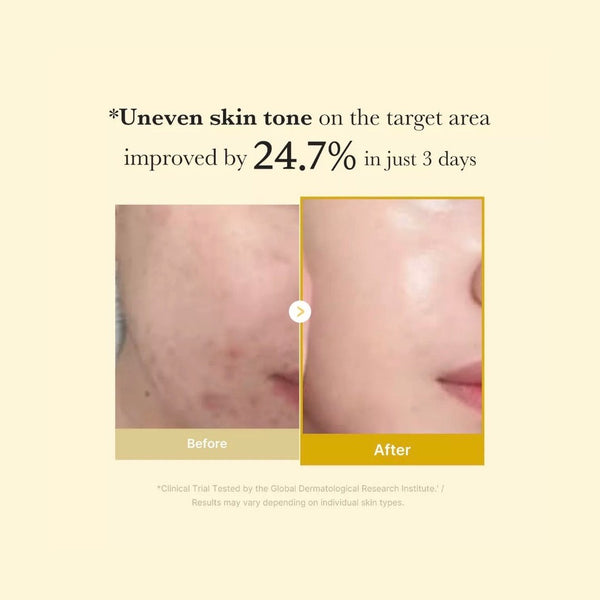 MEDICUBE Kojic Acid Turmeric Night Wrapping Mask 75ml