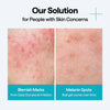 Mediheal Madecassoside Wrapping Serum Mask