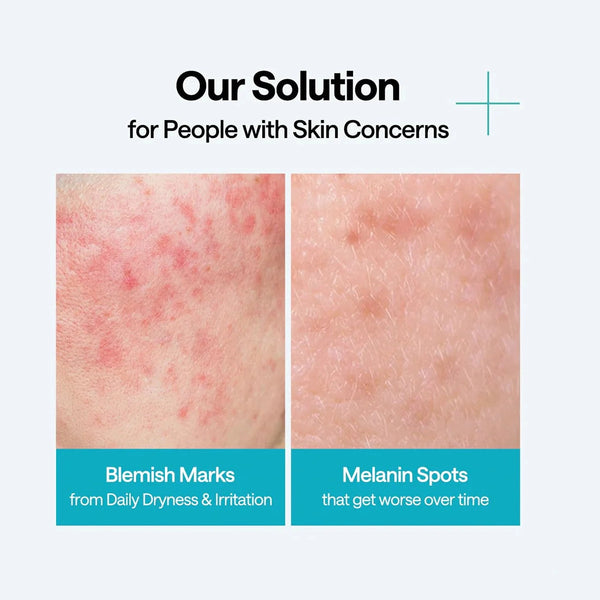 MEDIHEAL Madecassoside Wrapping Serum Mask
