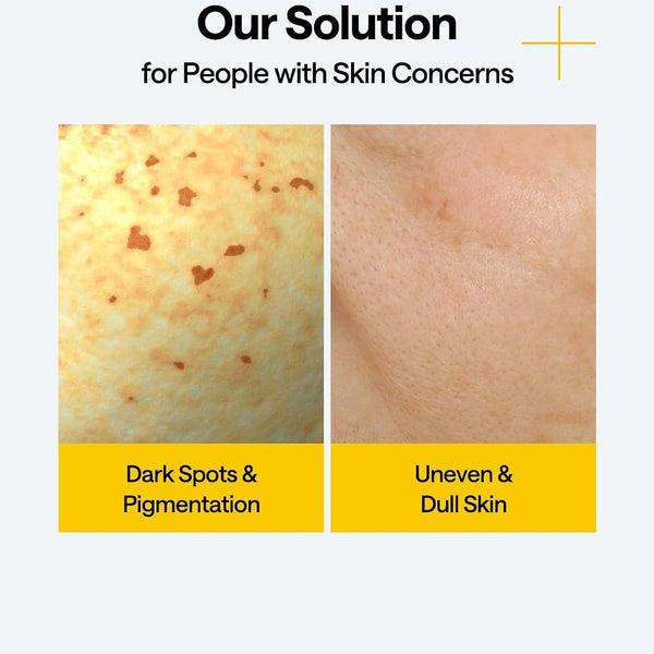 MEDIHEAL Vitamin C Wrapping Serum Mask