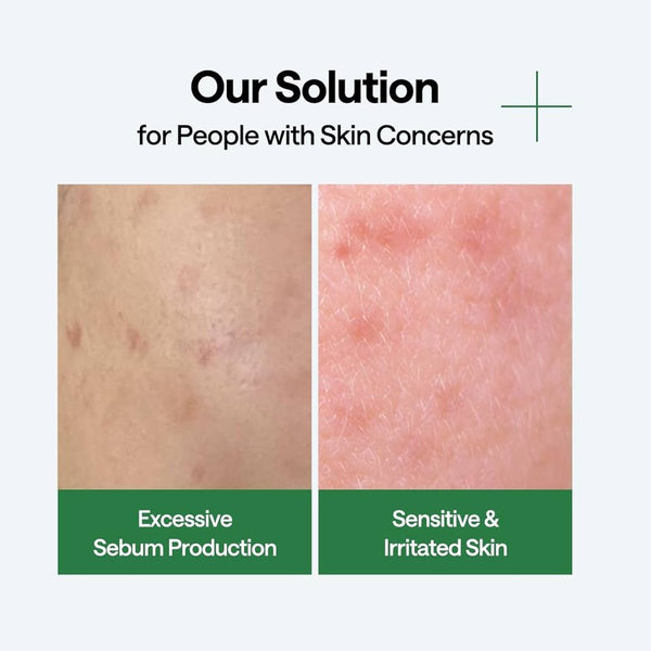 MEDIHEAL Tea Tree Wrapping Serum Mask