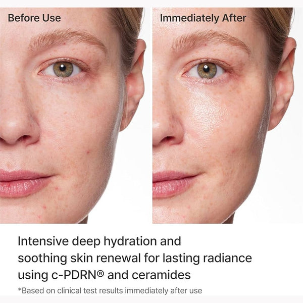 REJURAN Turnover Mask-Premium care with c-PDRN