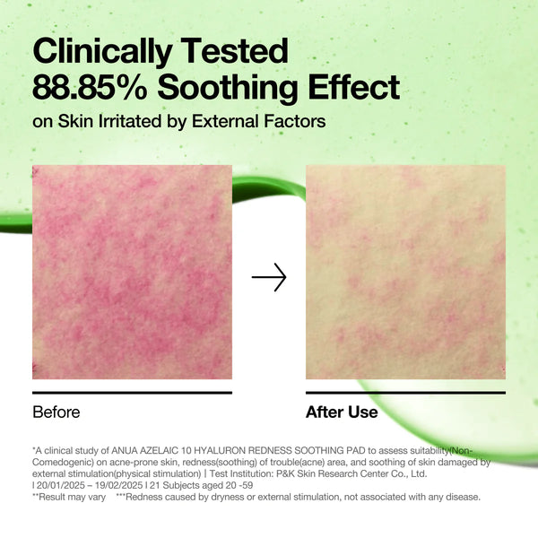ANUA Azelaic 10 Hyaluron Redness Soothing Pad （210ml / 60pads）