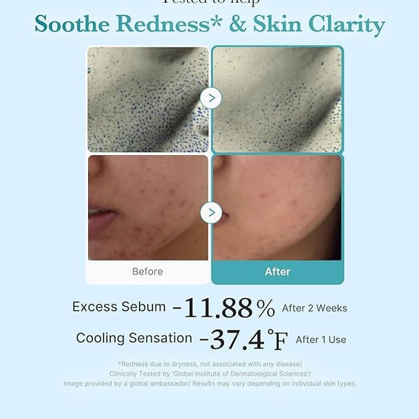 MEDICUBE Azelaic Acid Niacinamide Clarifying Toner 250ml