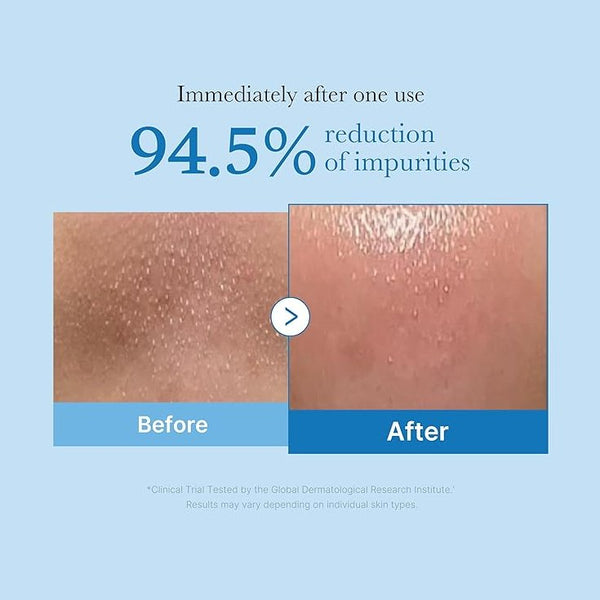 MEDICUBE Zero Pore Blackhead Deep Cleansing Oil 205ml