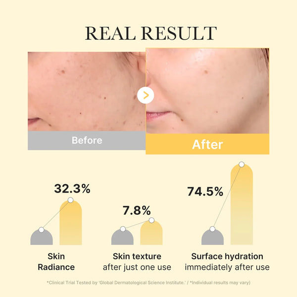 MEDICUBE Kojic Acid Turmeric Brightening Gel Mask 28g