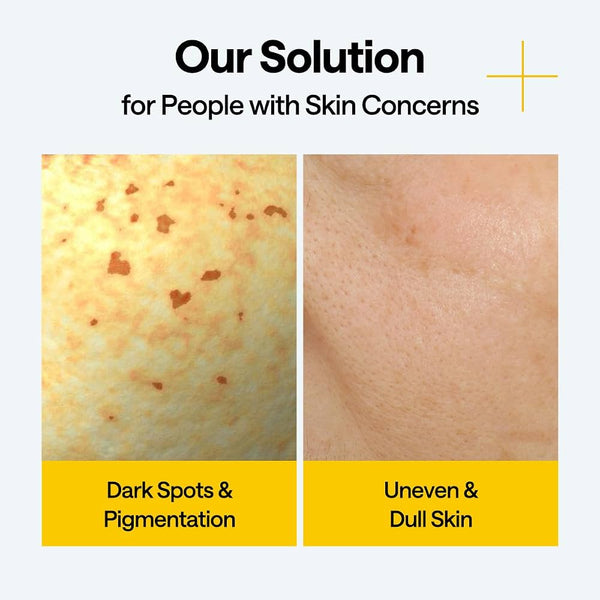 Mediheal Vitamin C Wrapping Serum Mask