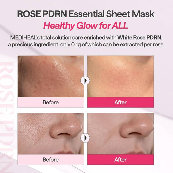 MEDIHEAL Rose PDRN Essential Mask-Healthy Glow