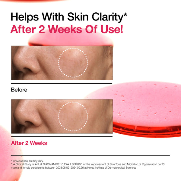 ANUA Niacinamide 10% +TXA 4% Serum 30ml